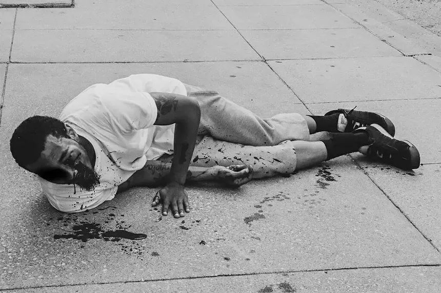 Brandon Saenz lies on a sidewalk bleeding from his eye after a Dallas police officer shot him in the face with "less-than-lethal" ammunition. - PHOTO PROVIDED BY ATTORNEY DARYL WASHINGTON