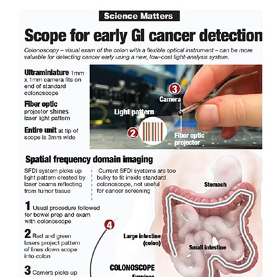 Science Matters: Scope for early GI cancer detection