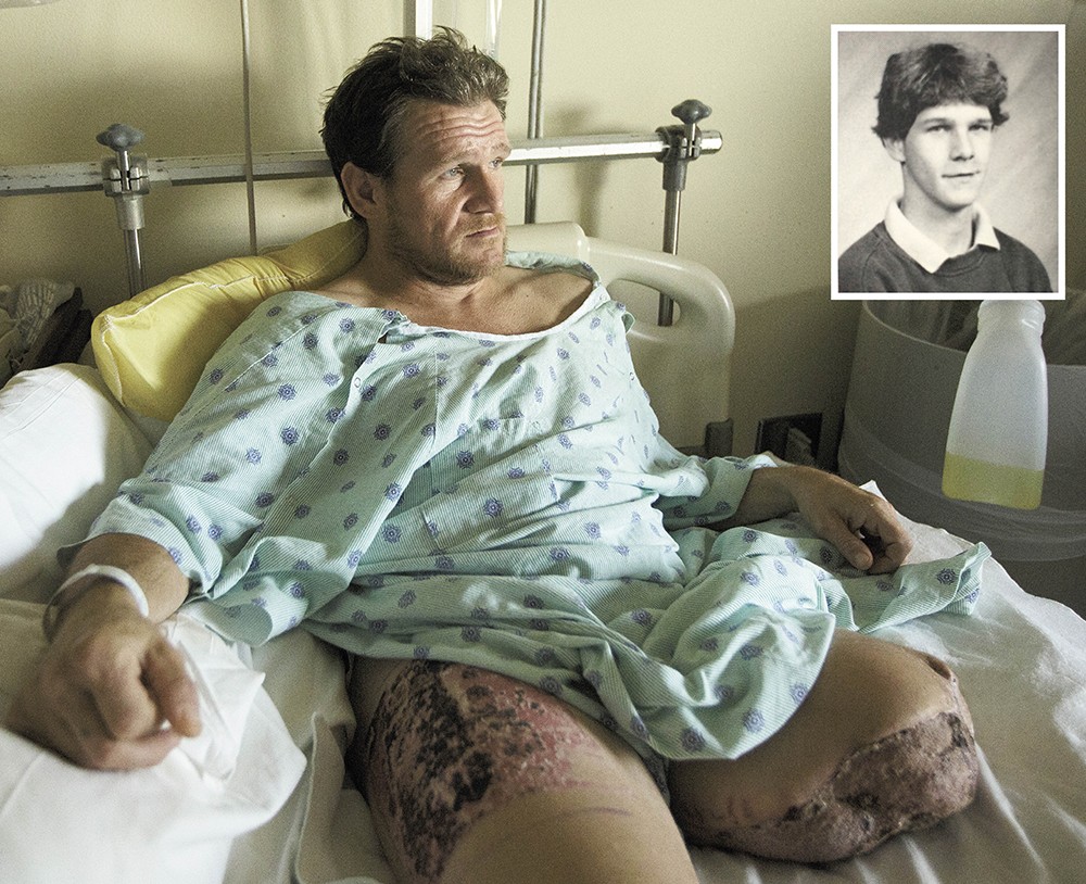 Chuck Lawrence passes the time in his hospital reliving the past 20 years of hitchhiking and hopping trains. A skin graft taken from his right thigh was used to treat his severed limb. INSET: A yearbook picture, dated 1993, showing him as a high school sophomore. - YOUNG KWAK