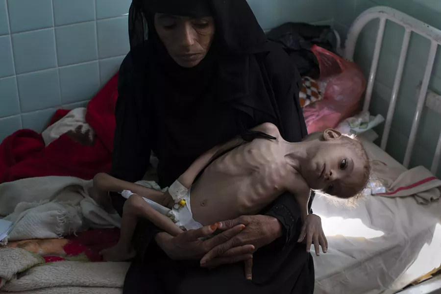 Bassam Mohammed Hassan, who suffers from severe malnutrition and cerebral palsy, is held by Madiya Ahmad, at a hospital in Sanaa, Yemen, on Oct. 15, 2018. Growing international concern over the dire humanitarian situation in Yemen, where the United Nations warns that a mass famine is looming, led to a concerted diplomatic push late October by the U.S. to finally get both sides around the peace table. But the pace of fighting has only escalated. - TYLER HICKS/THE NEW YORK TIMES