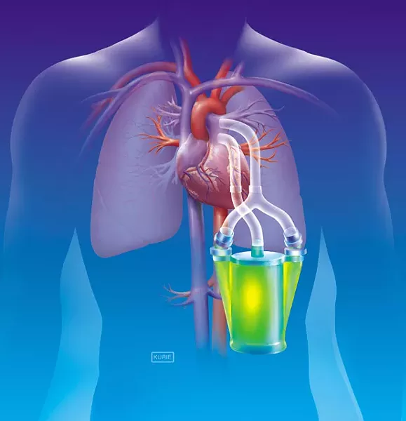 lung-pump.jpg