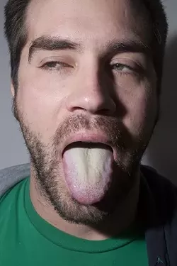 EWW : Spend a week on the Master Cleanse and you could have a tongue just like this. - PHOTO BY STEVE E. MILLER