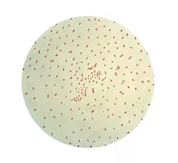 WHOOPING COUGH: This gram-stained micrograph depicts the virus that causes pertussis, also known as whooping cough. In 2014, there were 11,114 cases of pertussis in California. - PHOTO COURTESY OF THE CENTERS FOR DISEASE CONTROL