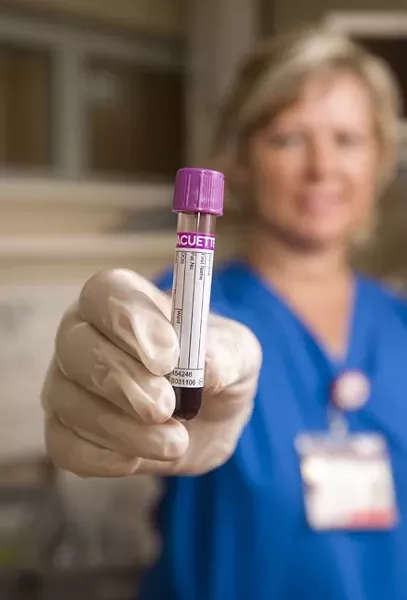 GET TESTED: The SLO Hep C project is offering free hepatitis C tests at locations throughout the county; call 543-4372 to find out more. - PHOTO COURTESY OF THE CENTERS FOR DISEASE CONTROL