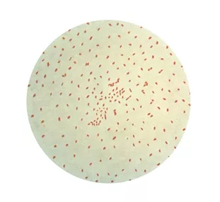 WHOOPING COUGH: This gram-stained micrograph depicts the virus that causes pertussis, also known as whooping cough. In 2014, there were 11,114 cases of pertussis in California. - PHOTO COURTESY OF THE CENTERS FOR DISEASE CONTROL