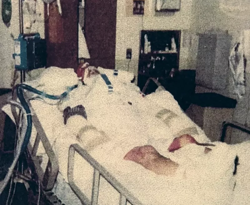A 1996 apartment fire left Weaver hospitalized, heavily bandaged and barely alive. - PHOTO COURTESY OF DAVIDE WEAVER