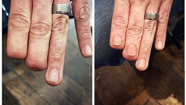His Hyper Realistic Fingernail Tattoo Went Viral Now He Plans To Help More People News Blog
