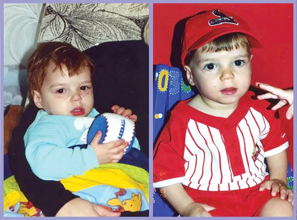 Laurie photographed Austin immediately after his adoption (left) and again ten days later. - COURTESY LAURIE CALZADA
