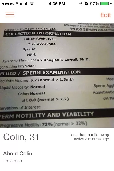 Sperm motility morphology - Porn archive