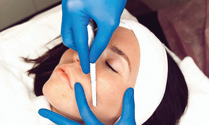 Dental Spa’s - dermaplane facial - COURTESY PHOTO