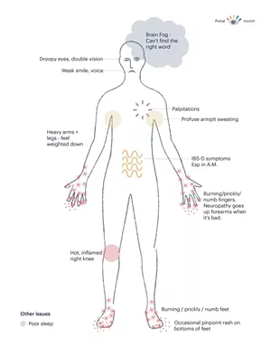 Sample symptoms - COURTESY OF KATIE MCCURDY