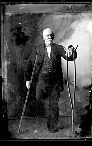 Portrait of a one-legged man - COURTESY