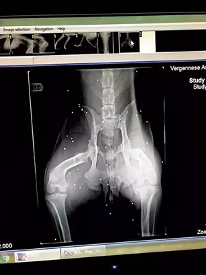 X-ray showing birdshot