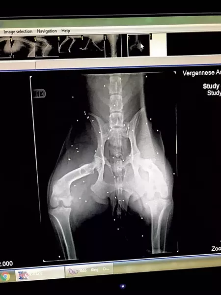X-ray showing birdshot
