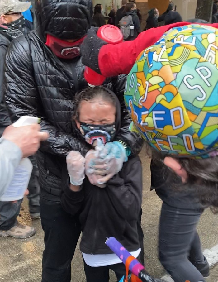 Protesters say this kid was Maced by an officer right before the video below was shot.