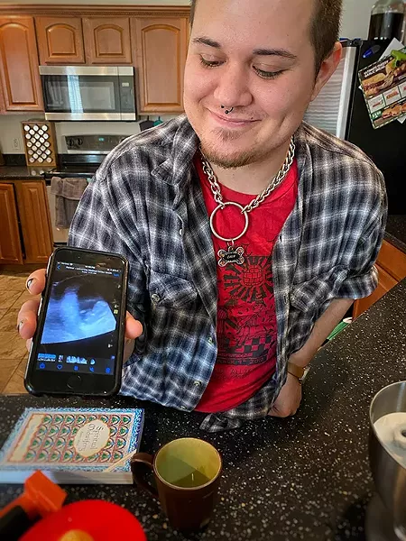 Cain and a shot from his ultrasound. - BRIAN SMITH